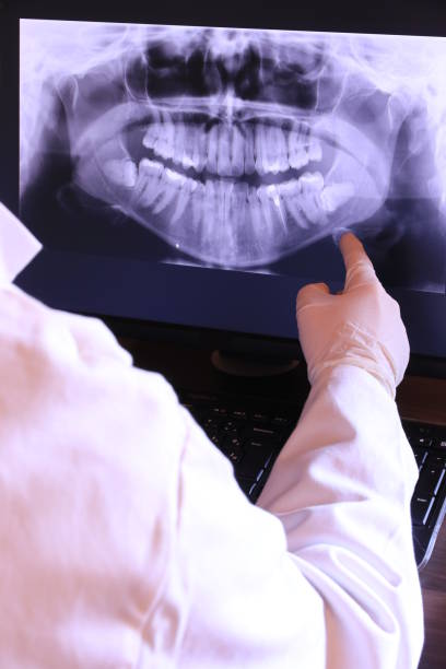 Best Emergency Root Canal Treatment in Beatrice, NE